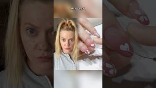Кого ещё достали прыщи😬 пиши + в коментах 😜🤝 #shorts #funny #music #trending #youtubeshorts