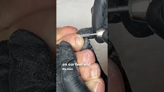 Don&#39;t push back the cuticle