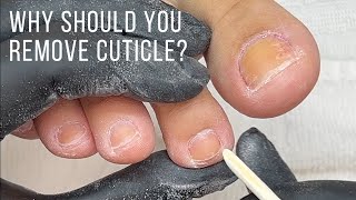 Why do you remove cuticle?