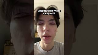 Моя операция на глаза в Корее🇰🇷 ТГК: Дэнчик
