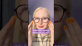 Мне сделали операцию на глаза в 5 лет ? #альбинизм #альбинос #глаза #операция #зрение