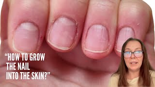 &quot;How to grow the nail into the skin?&quot;
