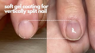 Can you repair a vertically splitting nail with gel?